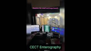 CT Scan Enterography [upl. by Hubey]