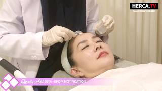 Mesopeel Glycolic Acid  HERCA [upl. by Consolata]