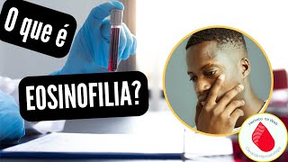 O que são EOSINÓFILOS aumentados EOSINOFILIA GEYDSON CRUZ MDMSc [upl. by Asreht869]