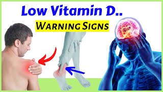 Signs of Vitamin D deficiency 12 Symptoms You Need To Know [upl. by Violeta]