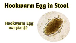 Hookworm eggs under microscope  Egg of Hookworm  Hookwarm Egg in Stool [upl. by Auqeenwahs777]