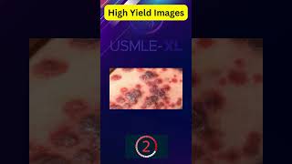 11 usmlestep1 medical firstaid highyield [upl. by Ddart677]