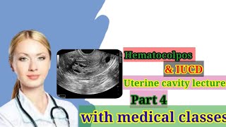 IUCD in Hindi uterine cavity cavity lecturepart 4  IUCD in ultrasound  Hematocolpos in Hindi [upl. by Agiaf]