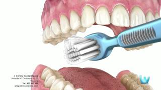 Higiene dental  Clinica identis [upl. by Blanchard]