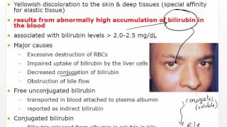 Chapter 30 Video Disorders of Hepatobiliary Liver and Pancreatic [upl. by Almira802]