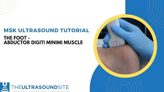 MSK ultrasound evaluation of the abductor digiti minimi muscle [upl. by Eahc133]