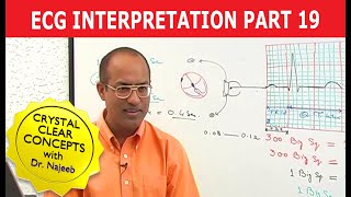 EKG or ECG Interpretation  Part 1920 [upl. by Jankell366]