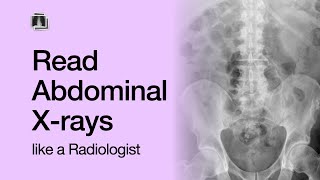 How to Read an Abdominal XRay [upl. by Leelah375]