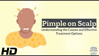 Scalp Pimples Unveiled Causes and How to Deal with Them [upl. by Sim]