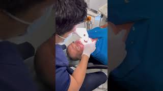 ¿Como se coloca un implante dental [upl. by Eioj855]