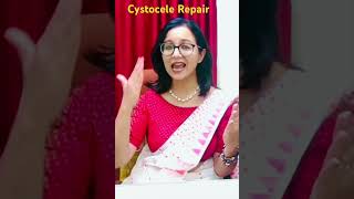 Cystocele Repair 👩‍⚕️ 3 Basic Principals [upl. by Neelloc]