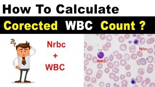 Corrected WBC Count  Clear Explain [upl. by Mufinella]