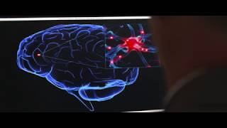 Cognitive symptoms following carbon monoxide poisoning [upl. by Ahsekam]