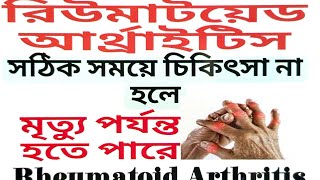 Discussion of Rheumatoid Arthritisরিউমেটোইড আর্থারাইটিসCausesHomeopathy TreatmentDiagnosis [upl. by Sidney]