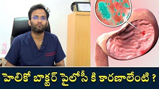 Helicobacter Pylori Diagnosis  హెలికో బాక్టర్ పైలోసీ కి కారణాలేంటి [upl. by Adolphus]