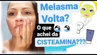 MELASMA RESULTADO DA CISTEAMINA [upl. by Cthrine]