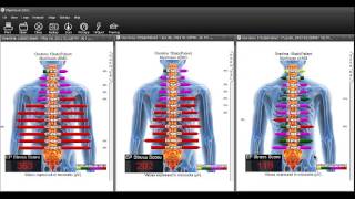 What is The EP Stress Score [upl. by Nileak]