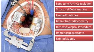 Development of a Bioengineered Decellularised Xenograft for Mitral Valve Replacement [upl. by Jami]