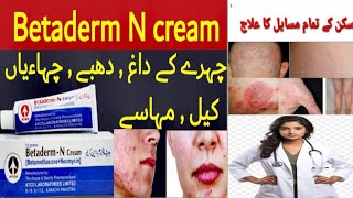 Betaderm N cream benefits uses side effects Urdu and Hindi doctorofmedicine [upl. by Ainesej]