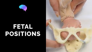 Types of Fetal Positions  OSCE Guide  UKMLA  CPSA [upl. by Ahsiruam490]