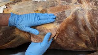 Anterior Abdominal Wall Muscles and the Abdominal Aponeurosis [upl. by Hal]