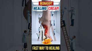 Heal Diabetic Foot Ulcers Fast with BeenaSoft Cream  Best Treatment for Bedsores shorts [upl. by Eatnuhs]