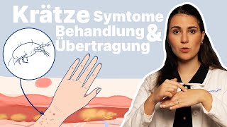 Krätze erkennen amp behandeln Was hilft bei infizierten Möbeln │Dr med Alice Martin [upl. by Basso]