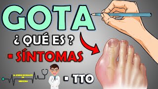 ¿QUÉ ES LA GOTA Y CUÁLES SON LOS SÍNTOMAS TRATAMIENTO 📝👨🏻‍⚕️ EXPLICACIÓN FÁCIL⚡ [upl. by Eirrotal500]