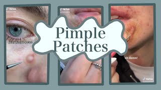 A Pimple Patch Tiktok Compilation [upl. by Byran369]