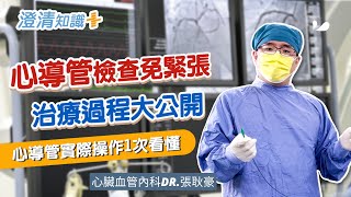 【澄清知識＋】心導管檢查 治療過程大公開心臟血管內科 張耿豪醫師 [upl. by Aikemal]