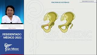 Traumatología  14 Lesiones de la pelvis [upl. by Herates]