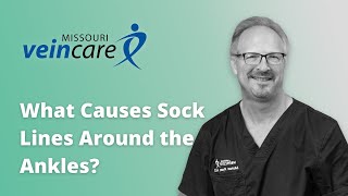 Unveiling the Mystery Behind Sock Lines [upl. by Zippora963]