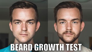 CPH Grooming vs Minoxidil  I tried both Beard Growth [upl. by Aenert]