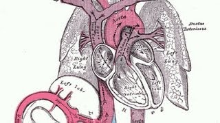 Why does Aortic Rupture cause so many deaths [upl. by Aneleh]