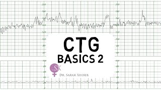 CTG Basics Part 2  Decelerations amp Fetal Physiology [upl. by Anilegnave]