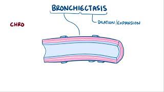 Bronchiectasis [upl. by Atarman]