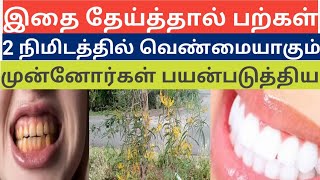 இது பல் கறைகளைப் போக்கி பல்லை வெண்மையாக மாற்றும் herbal tooth powder home remedy [upl. by Hotchkiss65]