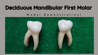 Mandibular Deciduous First Molar Morphology  Tooth Morphology [upl. by Clemente]