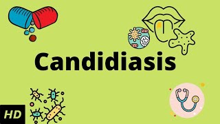 CANDIDIASIS Causes Signs and Symptoms Diagnosis and Treatment [upl. by Nannerb]