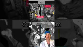 MRI vs CT🤔 Explained [upl. by Solomon]