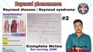 Raynaud phenomenon raynaud diseasesyndromeINTEGUMENTARYPROBLEMS BSCNURSING AND GNMrknursingpoint [upl. by Aevin350]