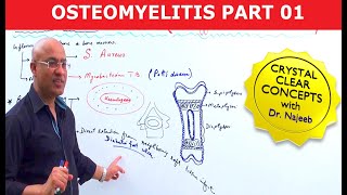 Osteomyelitis  Symptoms amp Causes🩺 [upl. by Wakerly]