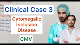 Clinical Case 3  Cytomegalic Inclusion Disease  CMV [upl. by Aleekahs]