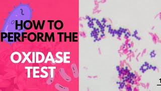 How to Perform the Oxidase TestMicrobiology [upl. by Fugate]