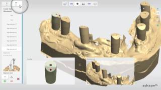 3Shape Dental System  Wax up Implant Bridge Scanning Workflow [upl. by Alyss]