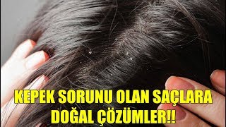 Doğal Yollardan Kepek Nasıl Giderilir 11 İpucu [upl. by Awe]