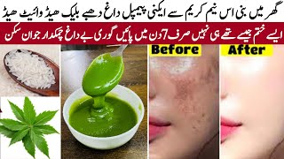 I applied👆🏻this magical neem face cream on Acne Pimples Pigmentation BumpsGlowing Skin in 7 days [upl. by Reuben704]