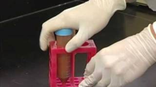 Video 6  DNA Extraction part 1 [upl. by Maribelle154]