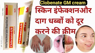 Clobenate GM cream  Clobenate GM cream uses in Hindi  दादखाजखुजली और दाग धब्बों पर असरदार क्रीम [upl. by Nasho354]