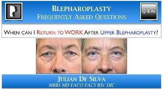 Upper Blepharoplasty Recovery Returning to Work after Upper Eyelid Lift Surgery [upl. by Pallaten794]